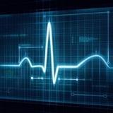 Learn ECG Easily