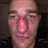 Лайв Sharit UFC