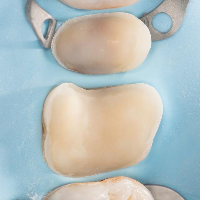 Biomimetic Restorative Dentistry