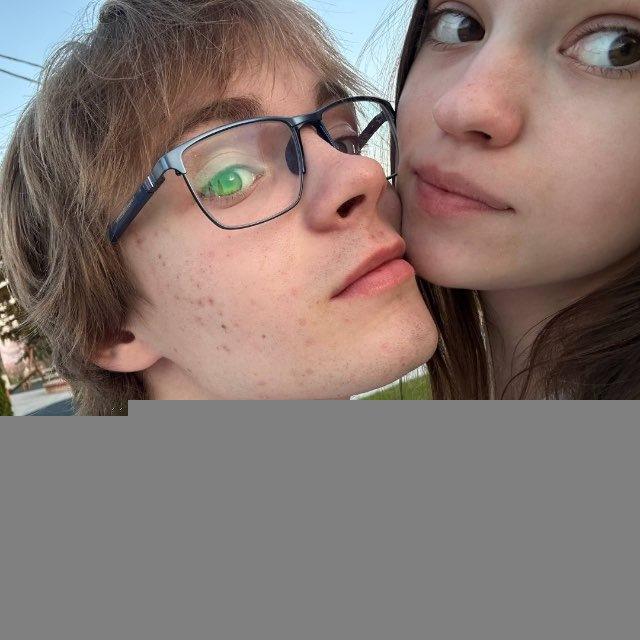 TUPOGOLOVKA😝