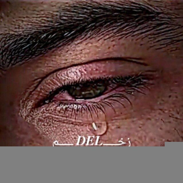 🥃 𓆩•.𝐙𝐀𝐊𝐇𝐌𝐈.• 𓆪↝ زخمے↯ 🥃