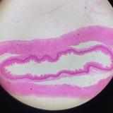 Medical Microbiology 2nd year