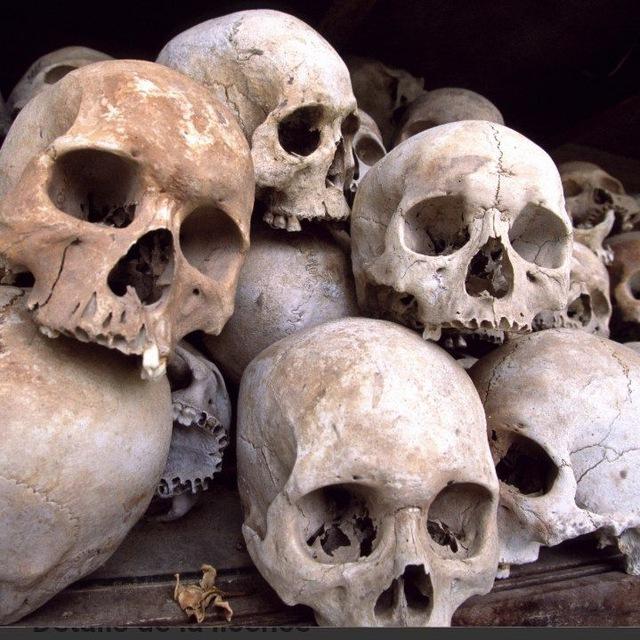 Forensic Anthropology / Bones / Trannies / Tranvestigation / Worldwide Deception