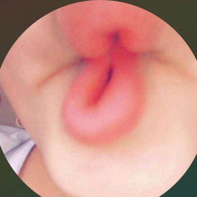الكيكه عبود 🏳️‍🌈🍭
