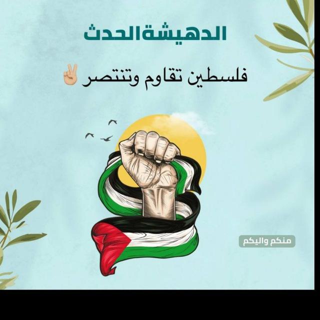 الدهيشة الحدث 𓂆