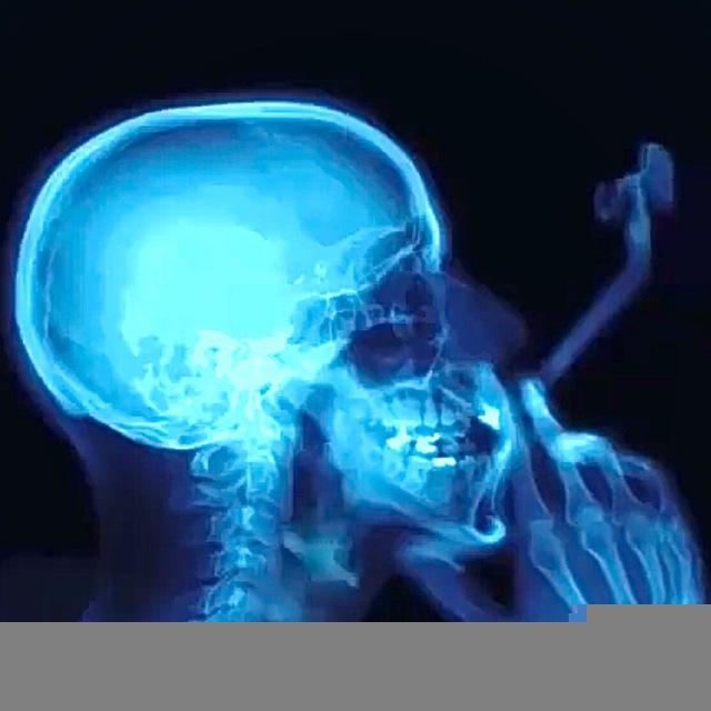 Paranoia