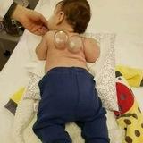 Hacamat sülük