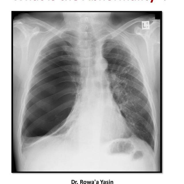 نماذج و محاضرات و ملخصات طب بشري