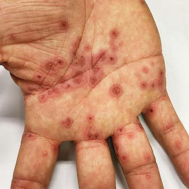 Temel Dermatoloji Vaka