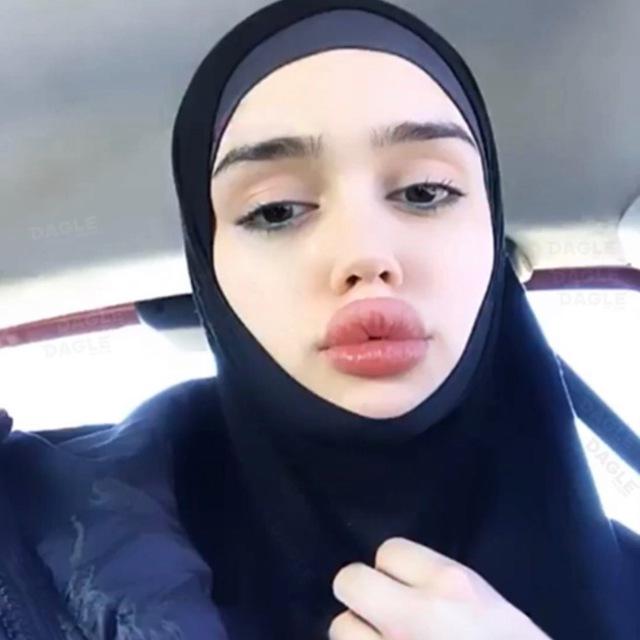 Rachid Aliyat Ebelex Anansig jinsiy aloqa حبيبي