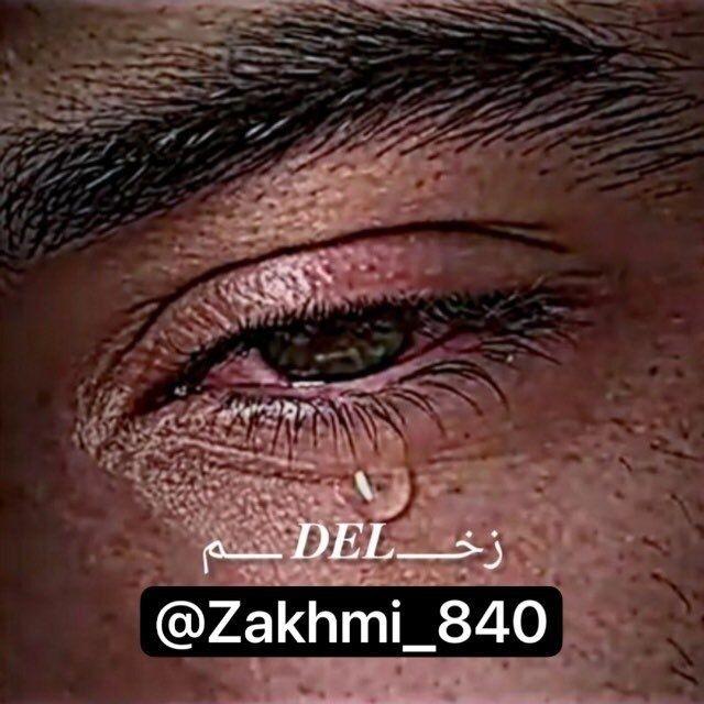 🥃 𓆩•.𝐙𝐀𝐊𝐇𝐌𝐈.• 𓆪↝ زخمے↯ 🥃
