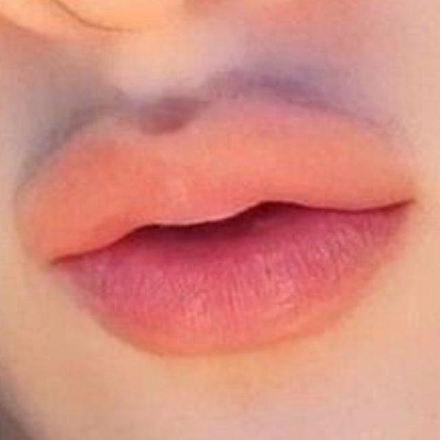 OH MY CHANNIE 💋