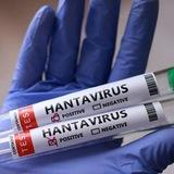 Хантавирус Новости | Hantavirus Пандемия