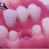 Fixed Prosthodontics Data.