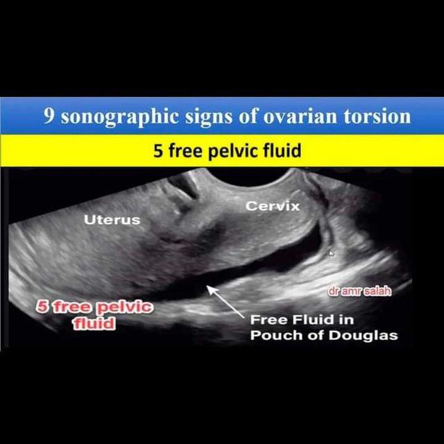 Ultrasound discussion