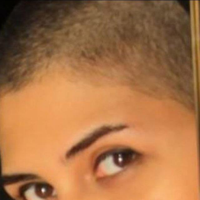 کافه کچل