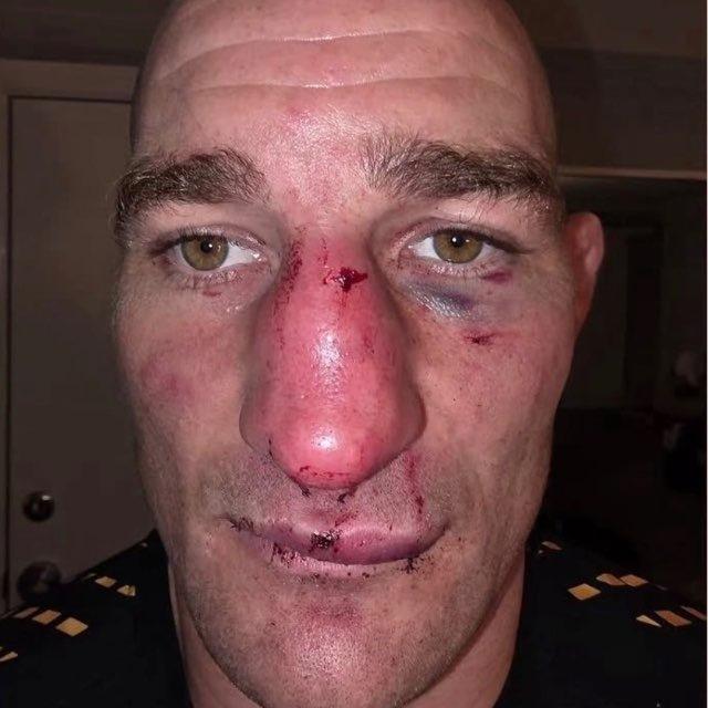 Лайв Sharit UFC