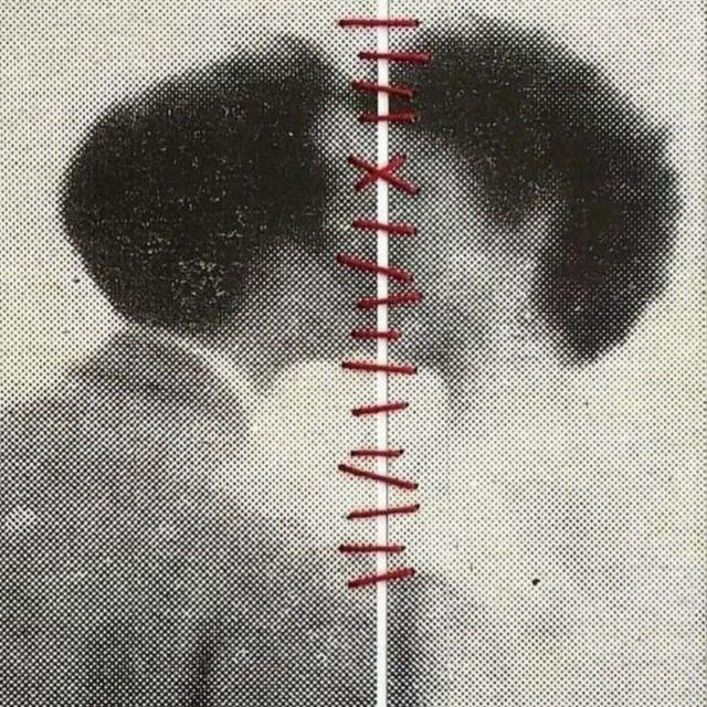 البرت بطرس.
