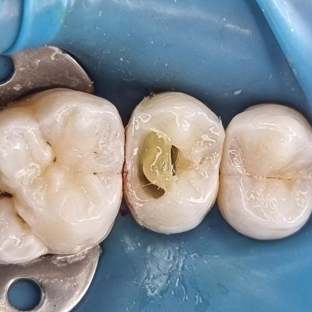 DENTAL MORDER🦷