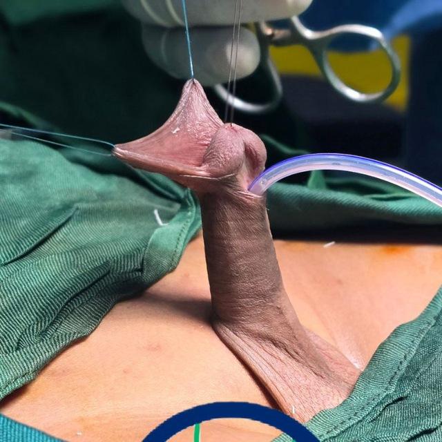Pediatric Surgery, Somalia
