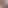 Brazzerton Xxxxxxxxxxxxxxxxxxbtc News 18 VideosEth
