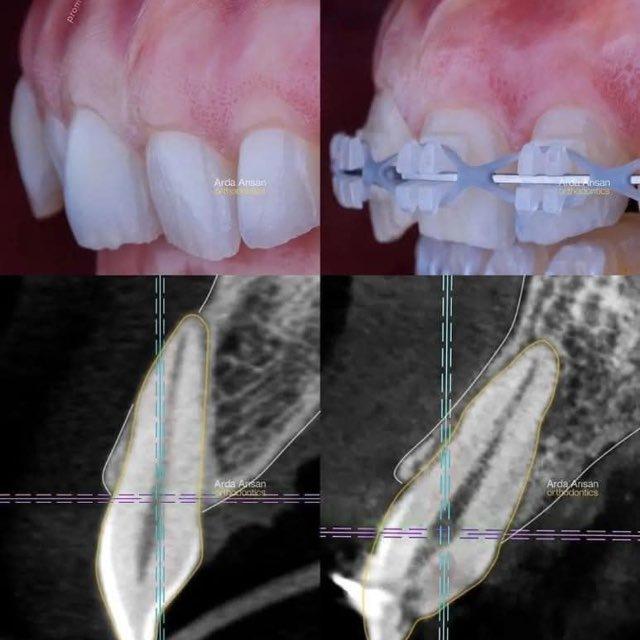 Modern dentistry channel 💜🦷