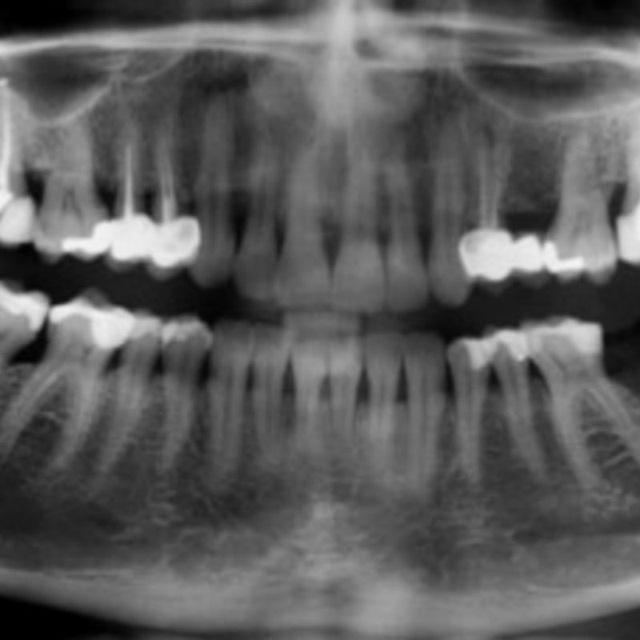 Oral diagnosis and Radiology 😞