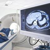 Рентгенология, КТ, МРТ (лучевая диагностика) - X-ray, CT, MRI (radiology diagnostics)