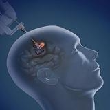 Neurosurgery Books (Salekan Publishing)