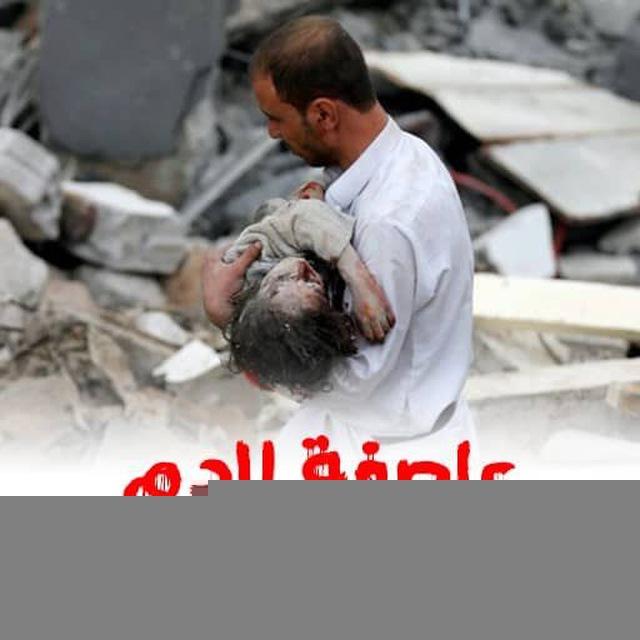جرائم العدوان السعودي ع اليمن
