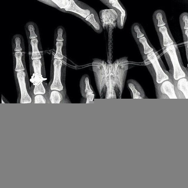بلوك عظام orthopedics