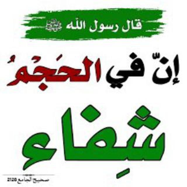 الحجامة شفاء مجربات الحجامين