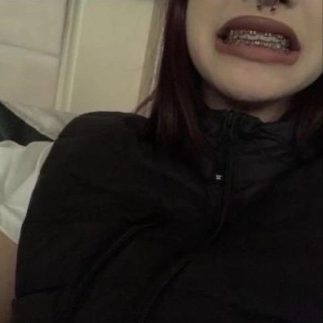 exposed