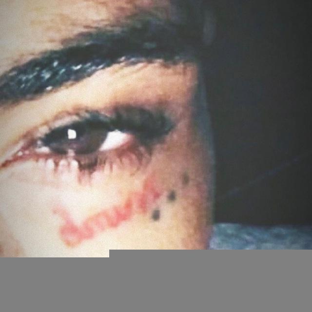 xxxtentacion