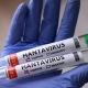 Хантавирус Новости | Hantavirus Пандемия