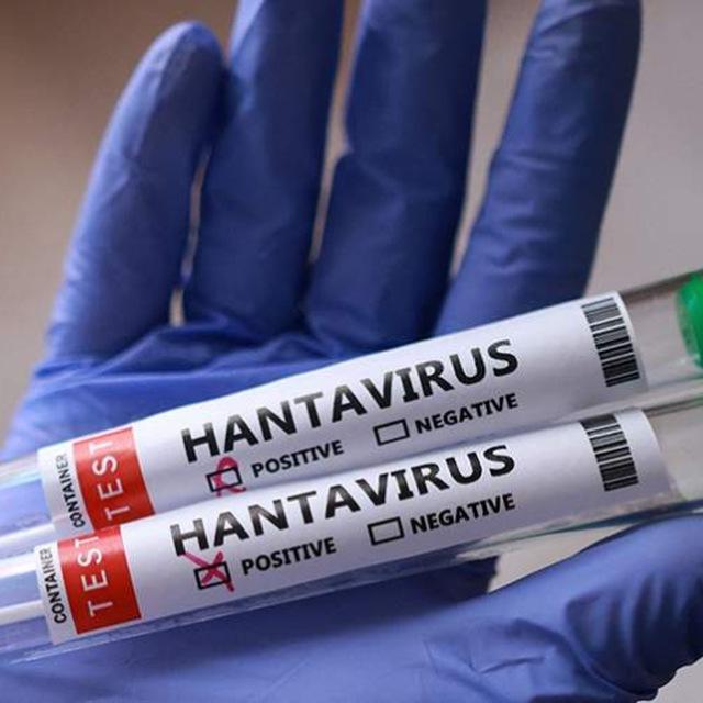 Хантавирус Новости | Hantavirus Пандемия
