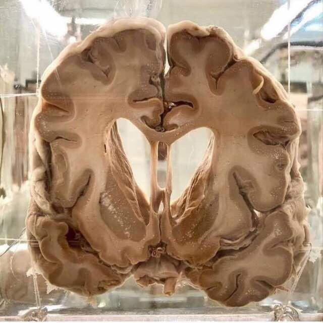 Neuro Safe