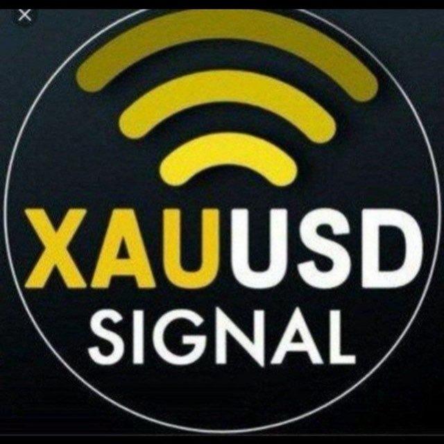 XAUUSD GOLD FOREX SIGNALS