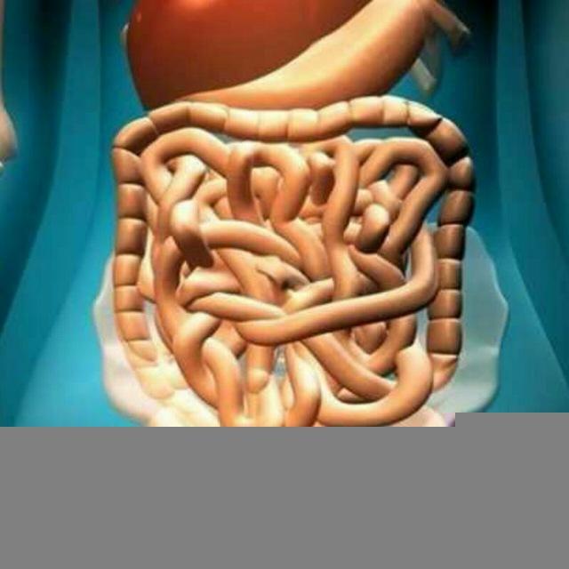 ibs سندروم روده تحریک پذیر ibs گوارش کولیت